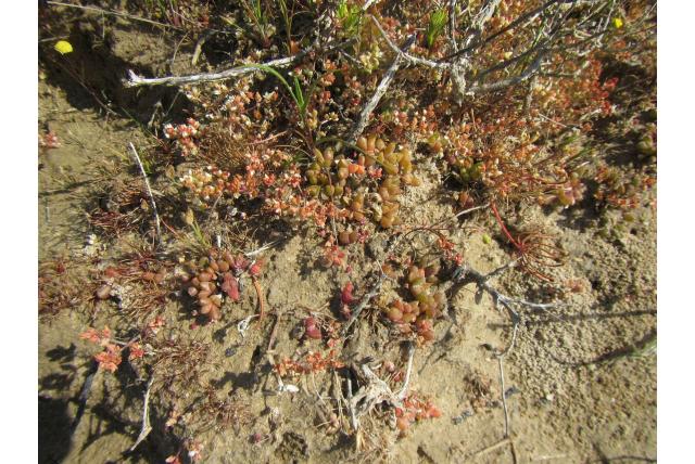 Dunsdon's disphyma Dunsdon's disphyma